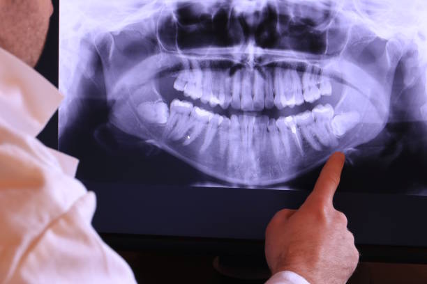 Best Pediatric Emergency Dentist in Wake Forest, NC