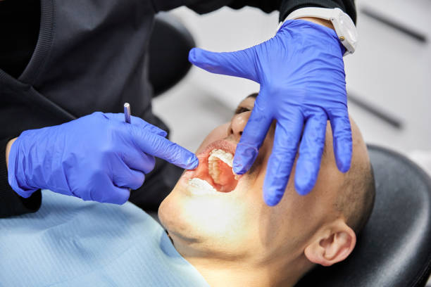 Best Emergency Tooth Extraction in Wake Forest, NC