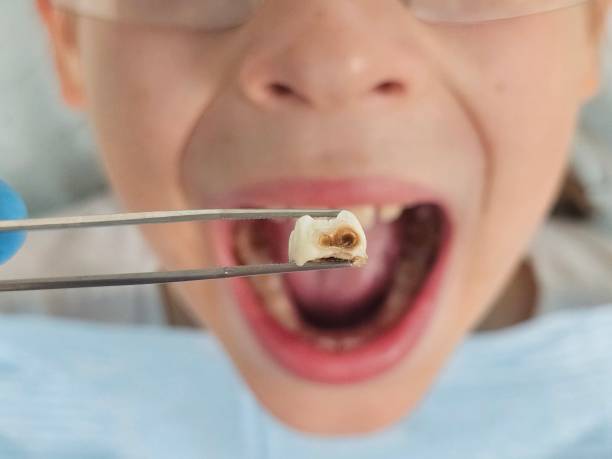 Best Same-Day Emergency Dentist in Wake Forest, NC